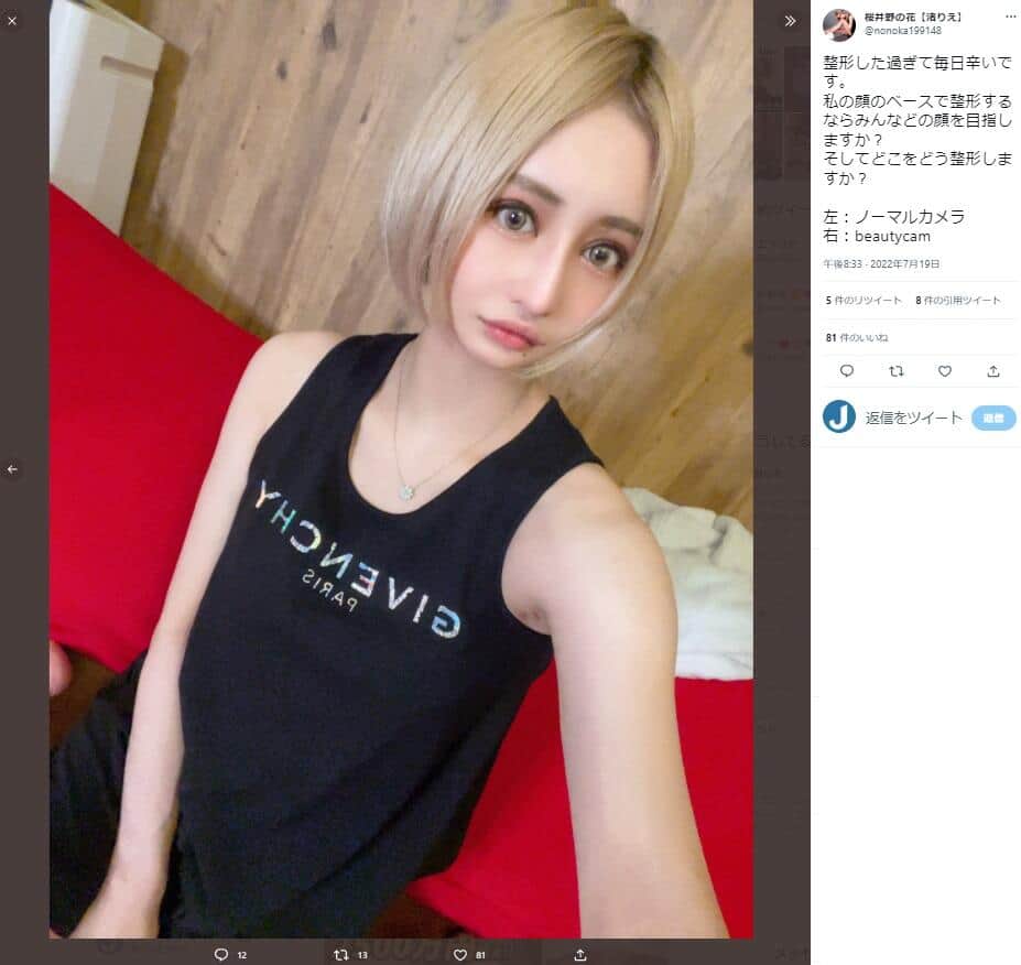 整形直後の姿が「とんでもないことに」　キャバ嬢YouTuberのレポートに衝撃「血が固まってて...」