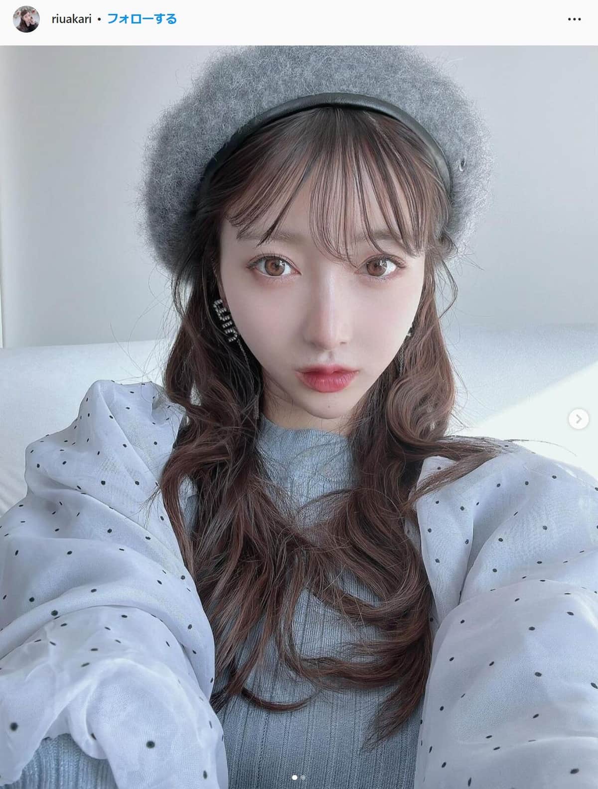 「誰かわからなかった」　整形公表YouTuber、容姿比較に嘆き「こうやってまとめられるの悲しい」