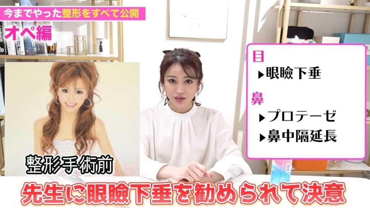 整形前の写真を披露した愛沢えみりさん。YouTubeチャンネル「愛沢えみりキャバ嬢社長MyLife」より