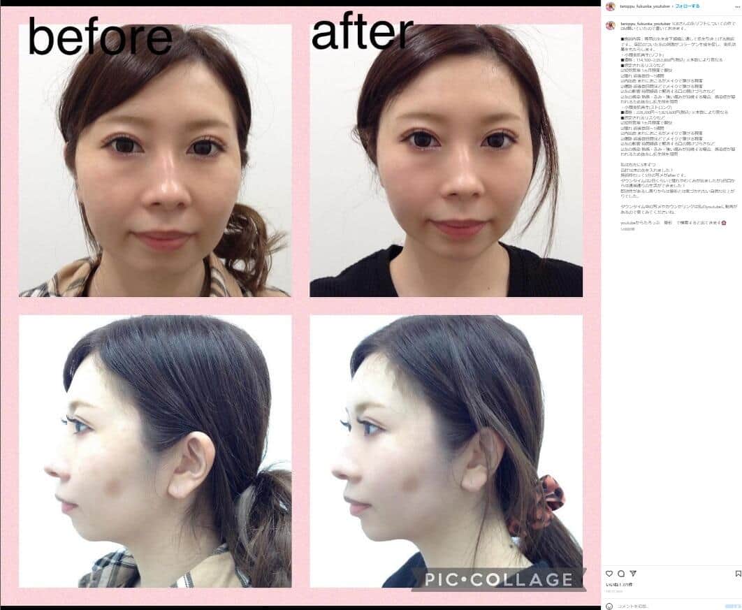 たろっぷさんのインスタグラム（taroppu_fukuoka_youtuber）より