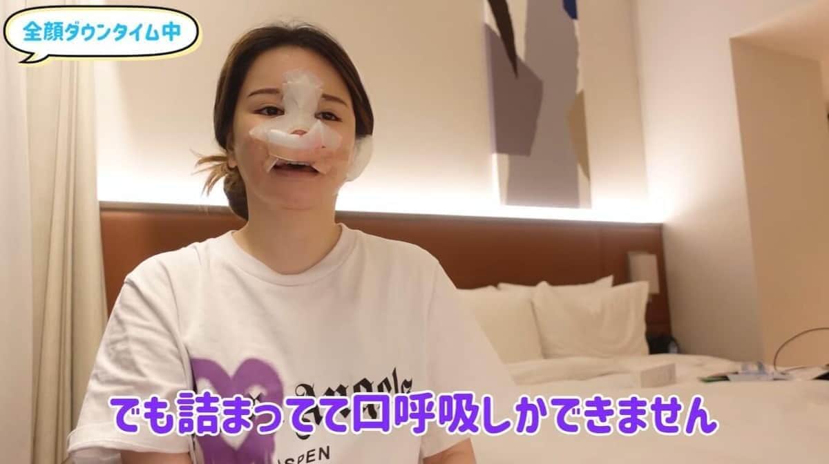 YouTubeチャンネル「整形らびちゃん」より
