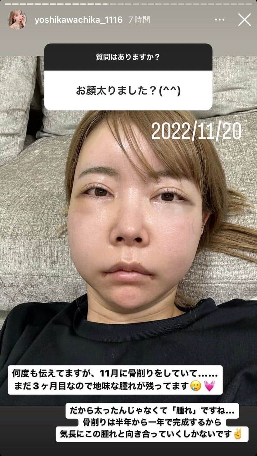 吉川ちかさんのインスタグラム（yoshikawachika_1116）より
