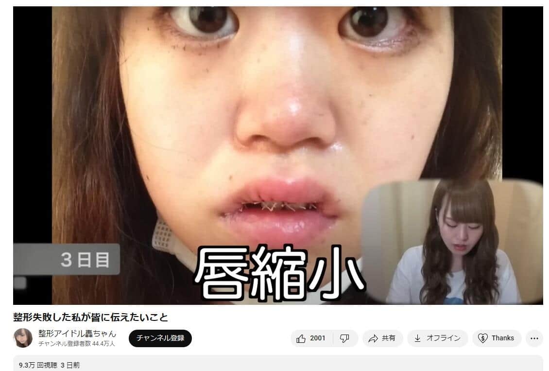 整形アイドル轟ちゃんのYouTubeより