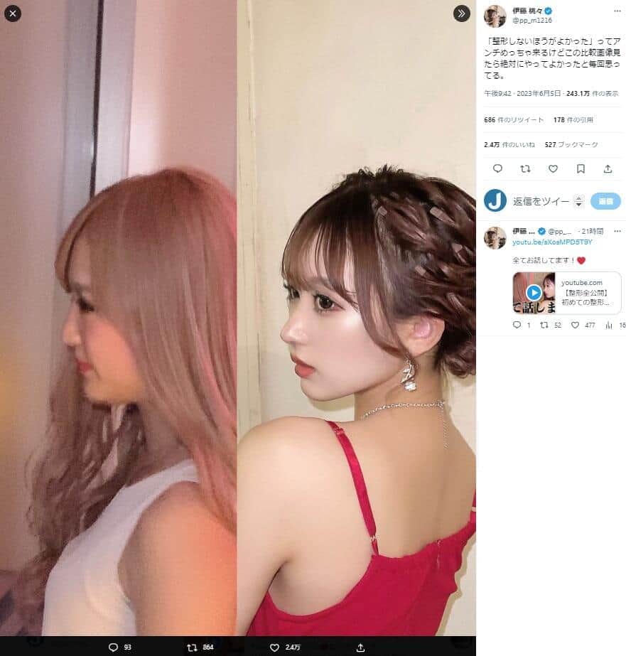 「整形しない方が良かった」大量アンチに人気モデル猛反論　「これ見ても言える？」比較写真公開