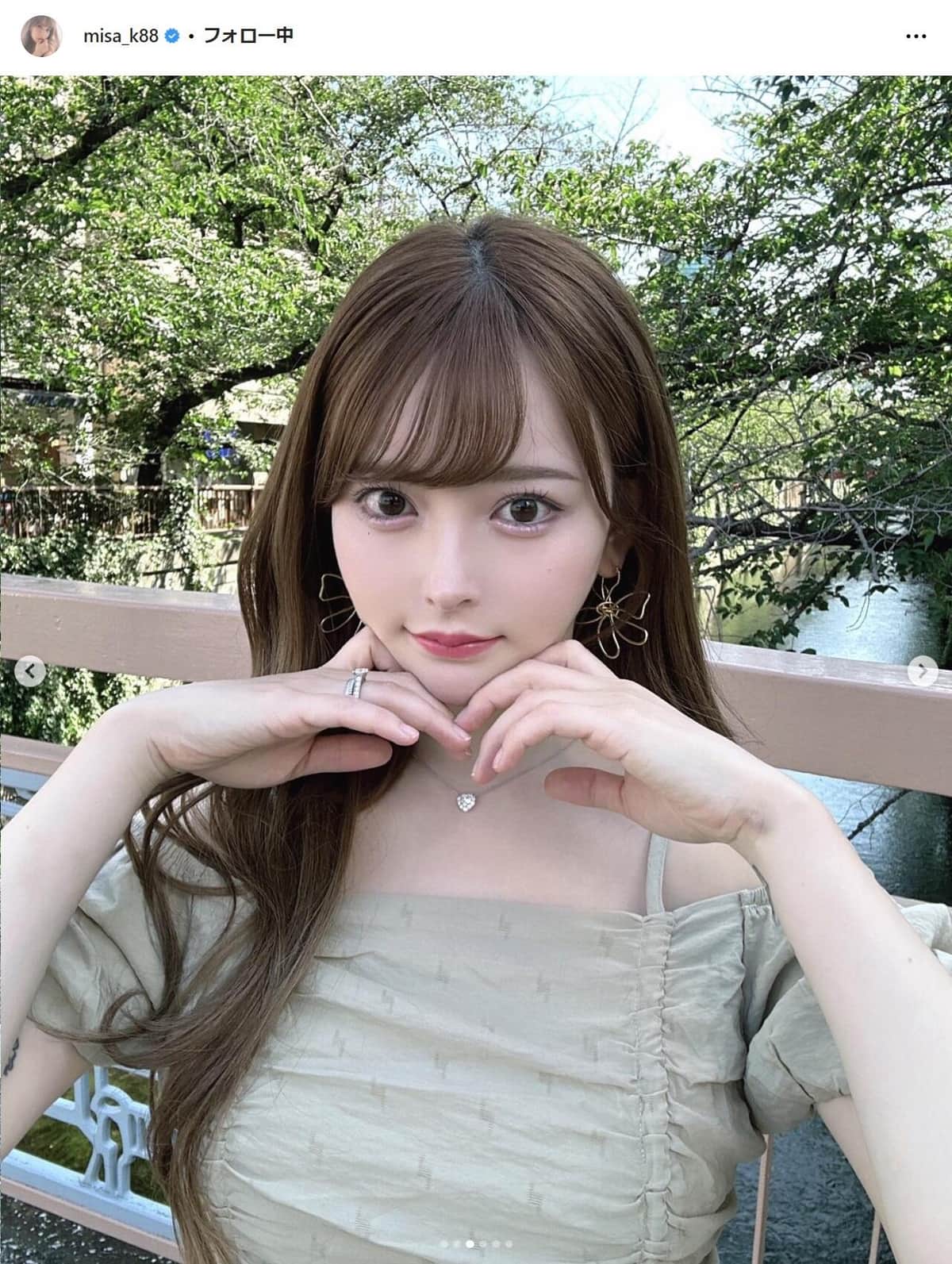 タトゥー「ない方が子供には良い」「実際あったらみんな距離取る」　双子母整形インフルエンサーが除去報告