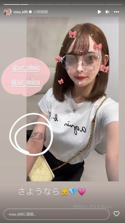 除去を報告したタトゥー。黒崎みささんのインスタグラム（misa_k88）より