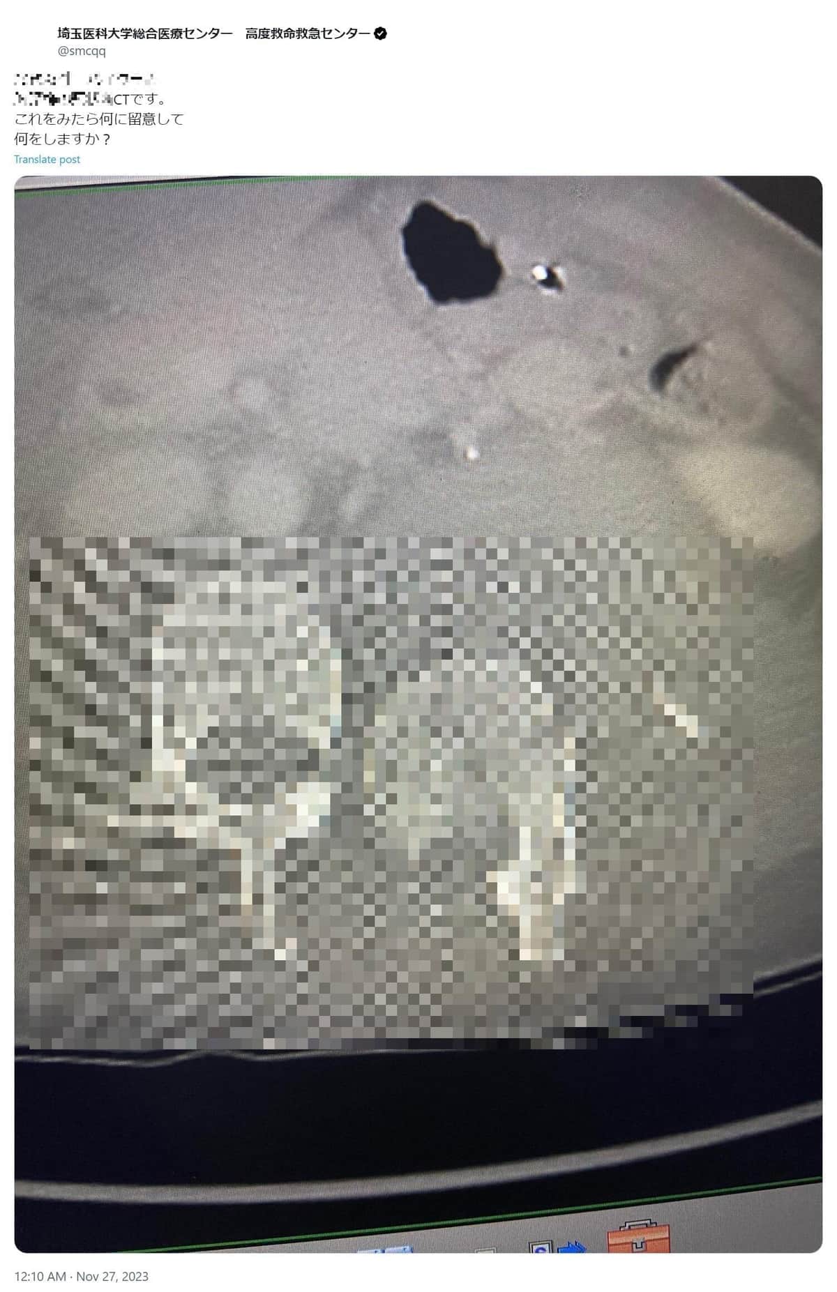 Xアカウント「埼玉医科大学総合医療センター高度救命救急センター」（＠smcqq）の削除された投稿、アーカイブより（編集部で一部加工）
