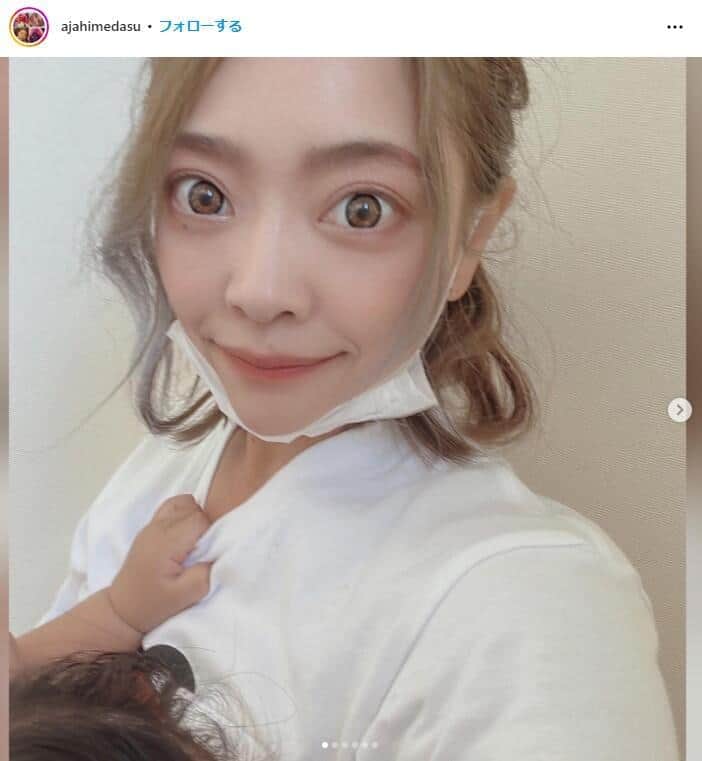 蕁麻疹の息子を児童館で遊ばせ...症状悪化＆家族が激怒「ありえないから！」　元ヤマンバギャル反省「安静にすべきでした」