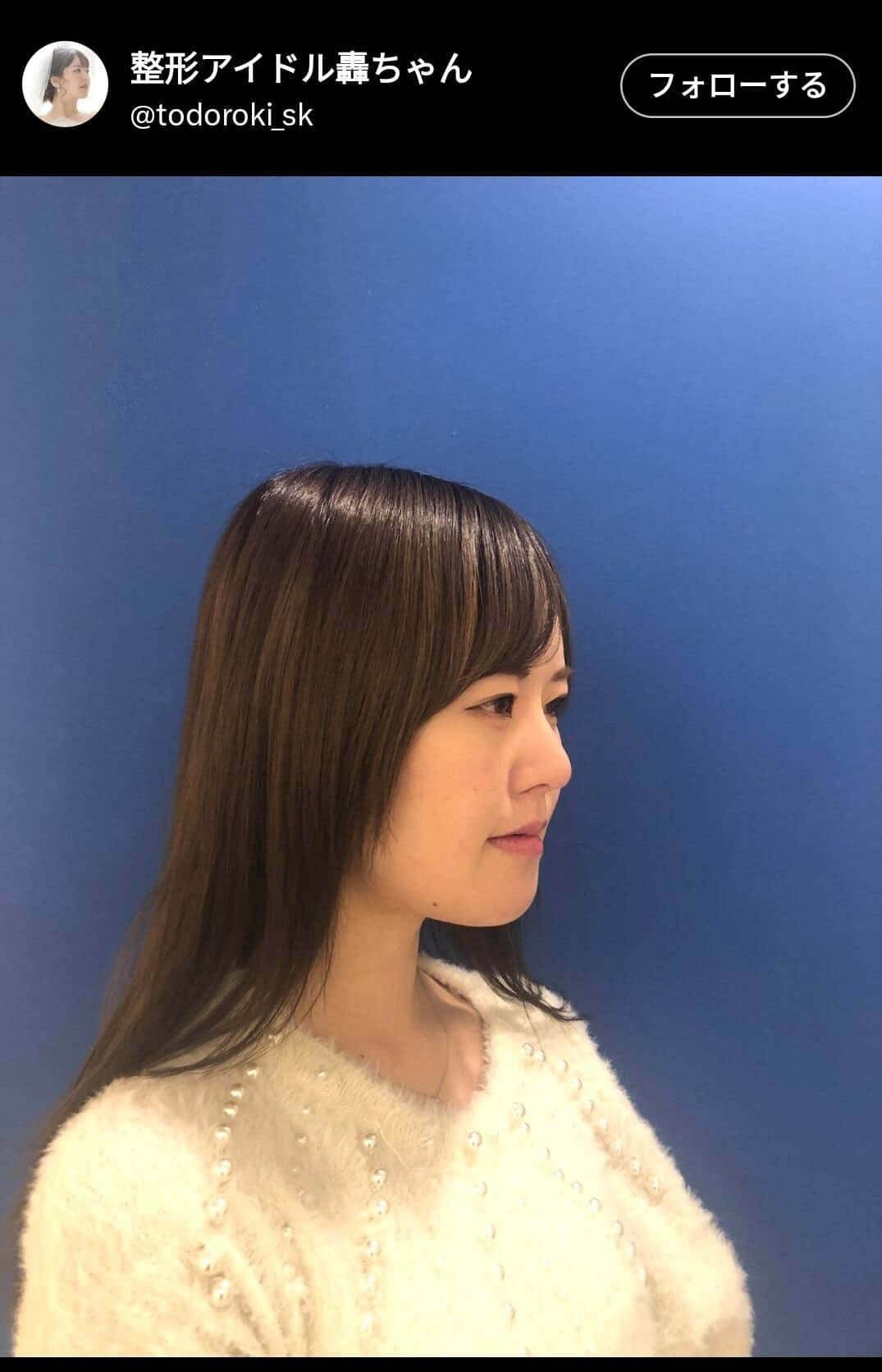 整形アイドル轟ちゃんのXより