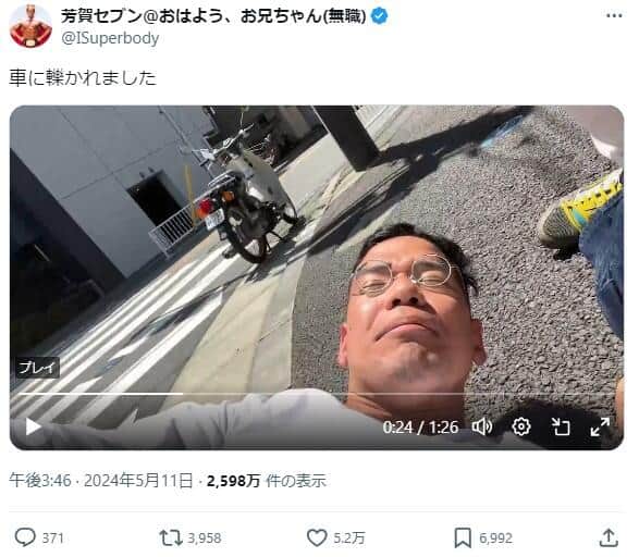 筋肉系YouTuberが交通事故で負傷、それでも「3時間後にジム行って......」　X報告にネット驚愕「タフすぎて怖い」