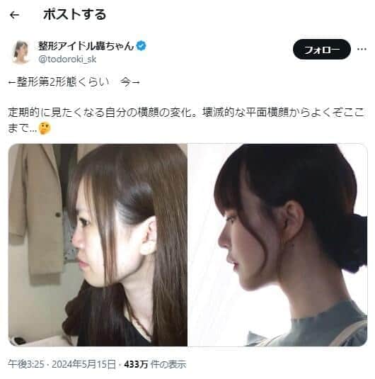 「整形アイドル轟ちゃん」のX（＠todoroki_sk）より