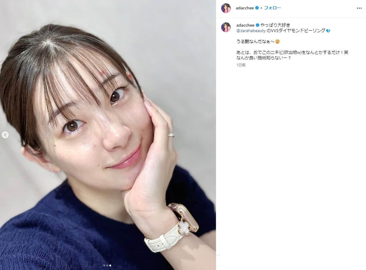 足立梨花さんのインスタグラム（＠adacchee）より