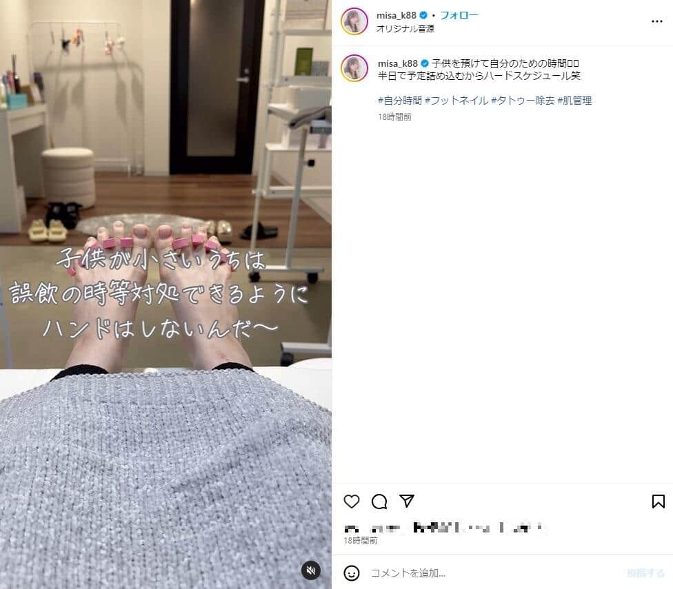 双子ママインフルエンサー、タトゥー除去の経過報告 「1年でこんなに