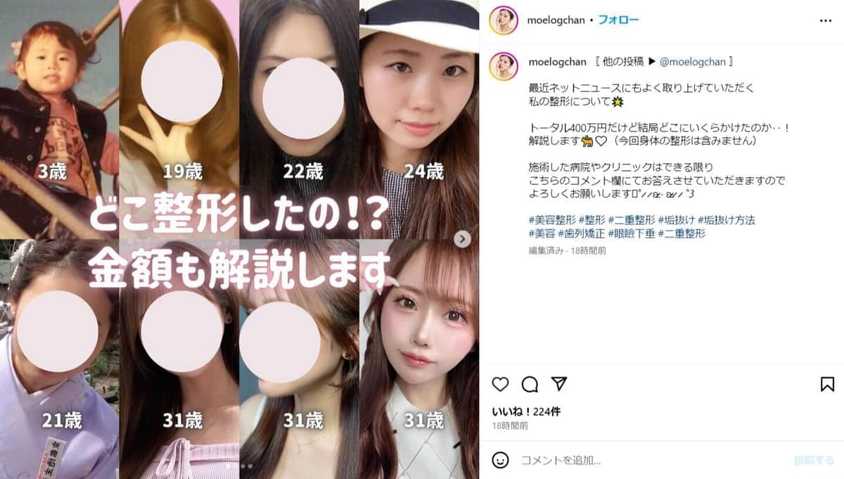 山崎もえさんのインスタグラム（＠moelogchan）より