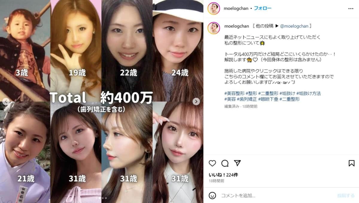 山崎もえさんのインスタグラム（＠moelogchan）より