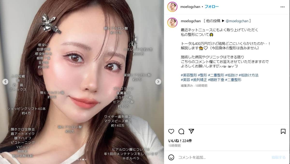 山崎もえさんのインスタグラム（＠moelogchan）より