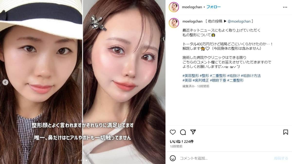 山崎もえさんのインスタグラム（＠moelogchan）より