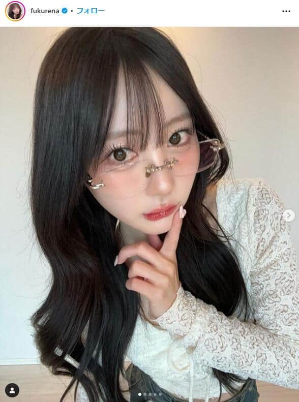 登録者186万YouTuber、鼻整形でダウンタイム公開　顔面アザだらけの経過...「寛大に見てもらいたい」