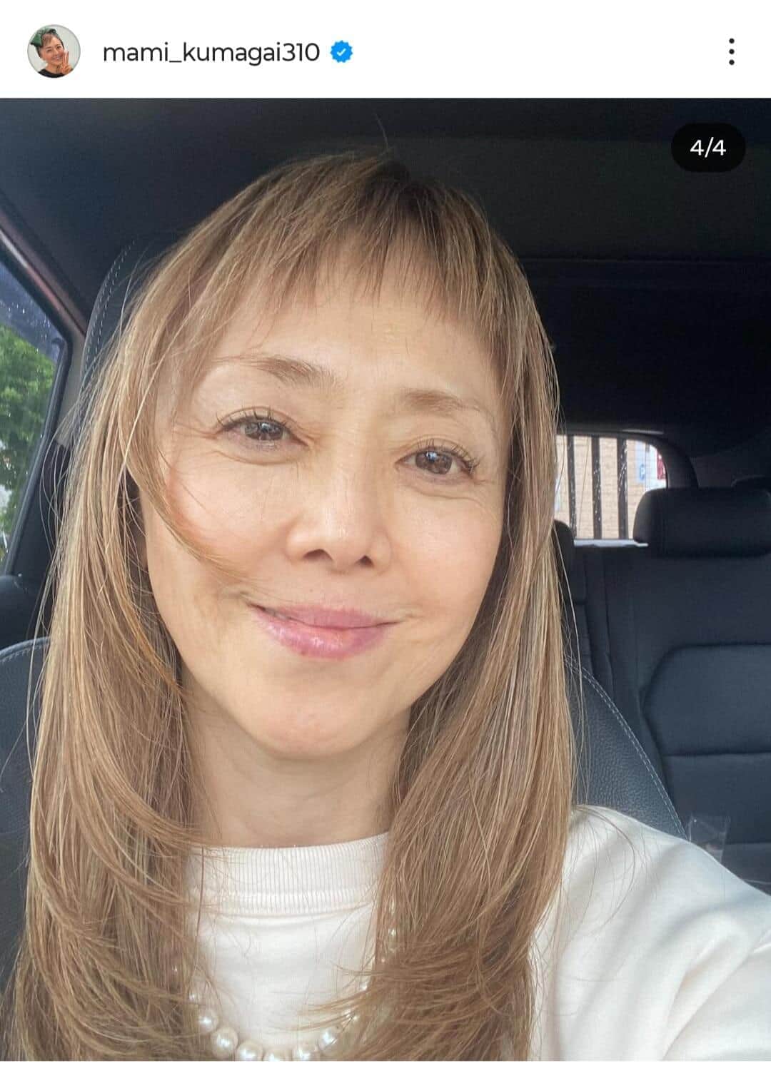 熊谷真実「まさかの円形ハゲが！」頭頂部を公開　「いつストレスを感じていたのか...」