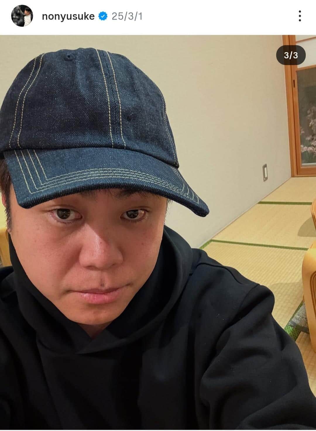 一瞬、誰...？ノンスタ井上裕介、美容施術で「別人級」激変　「お目々ぱっちり」「イケメンになりましたね」