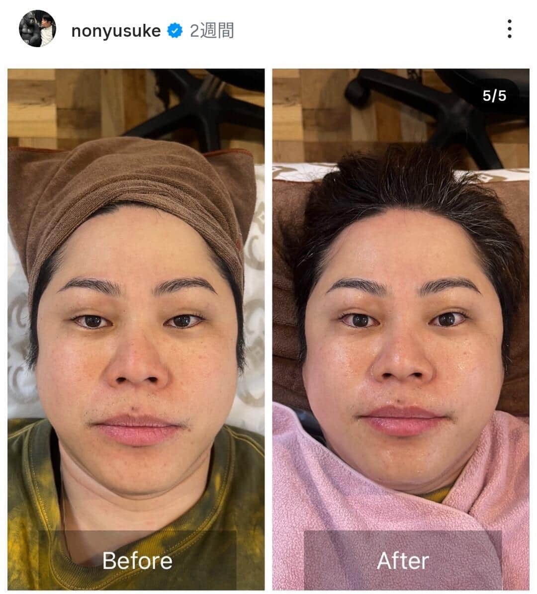 井上裕介さんのインスタグラム（＠nonyusuke）より