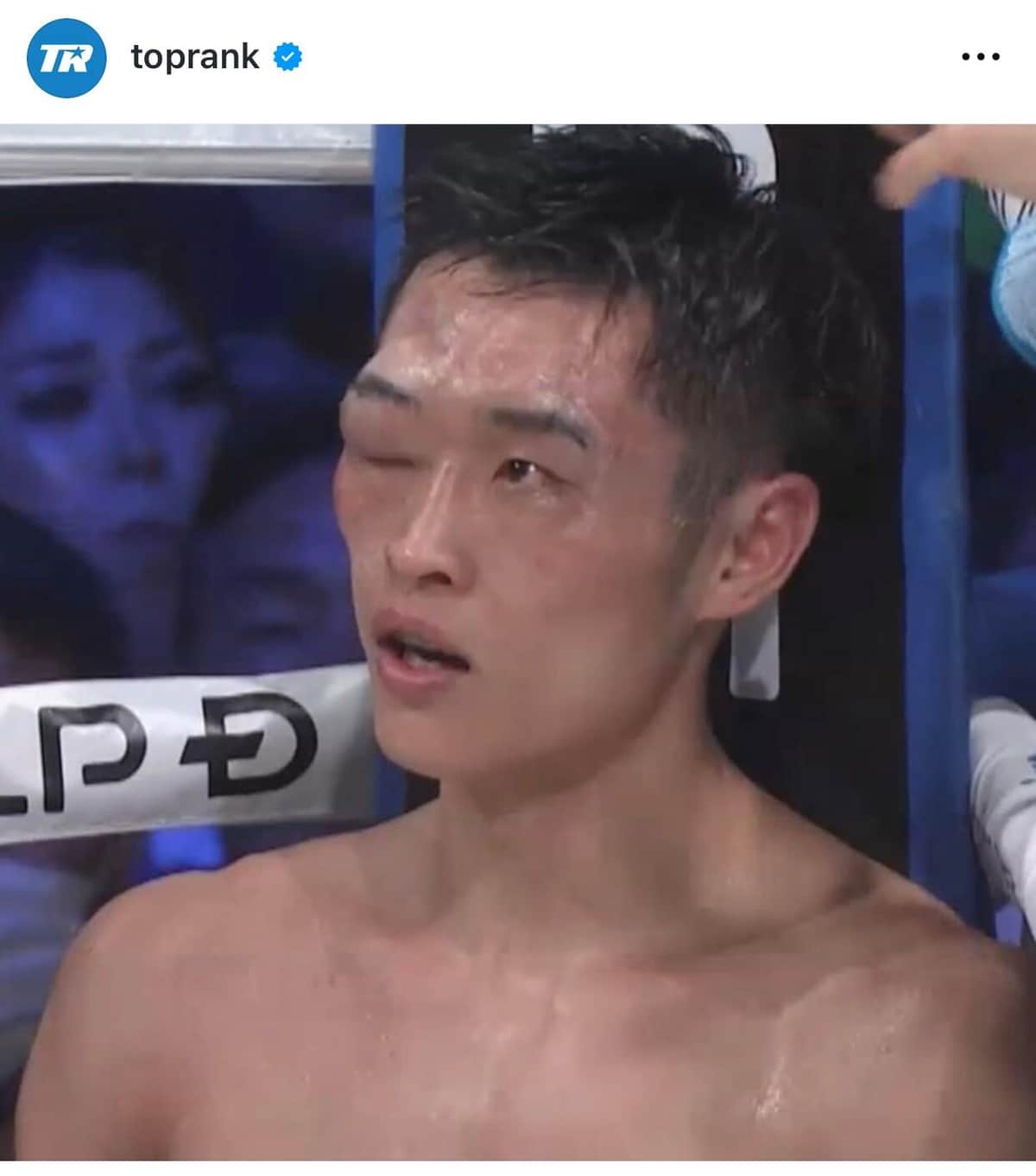 TKO負けした西田選手（トップランク社インスタグラムより）