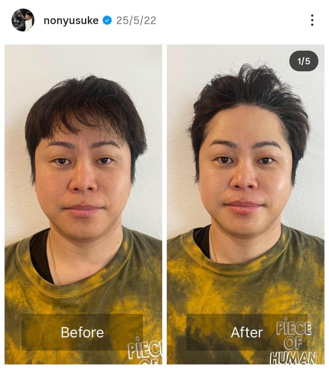 井上裕介さんのインスタグラム（＠nonyusuke）より