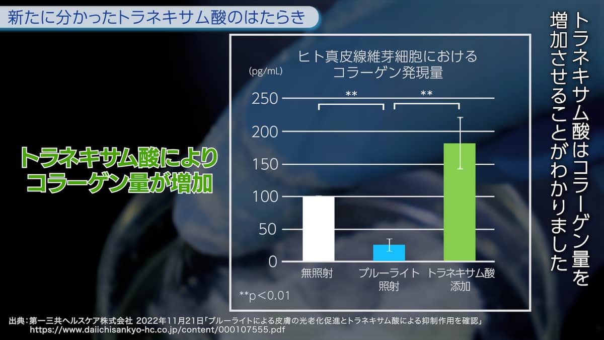 トラネキサム酸にコラーゲン量を増加させる働きがあることが判明