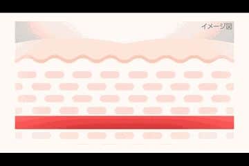 トラネキサム酸は、炎症に関わる物質を誘発するプラスミンを抑える働きがある