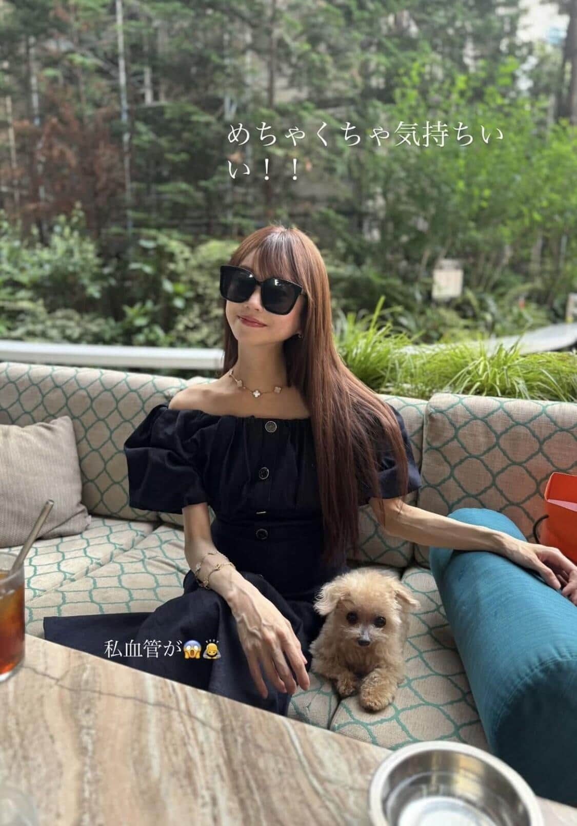 愛沢えみりさんがインスタストーリーズに投稿した写真。腕の血管に心配の声が相次いでいる