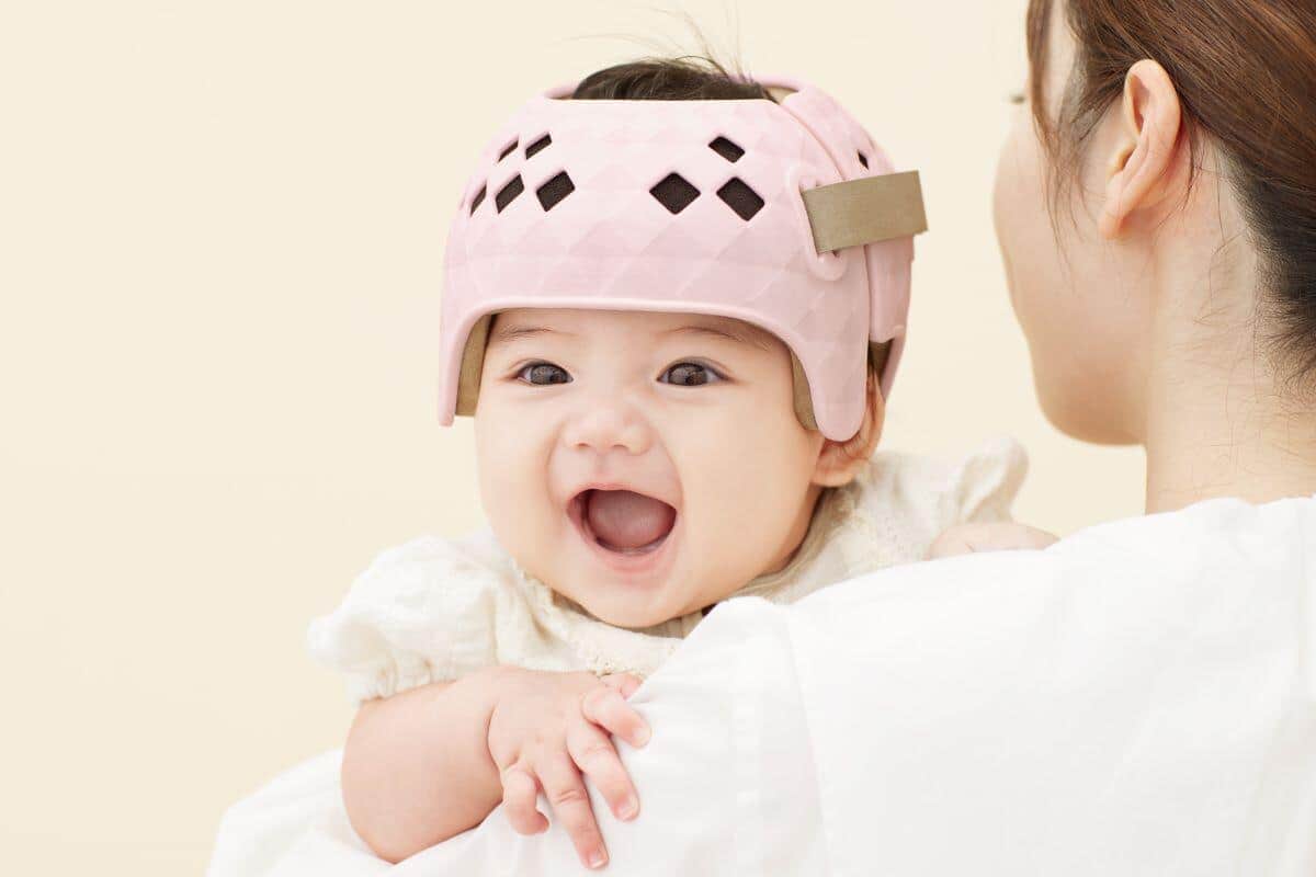 Xでザワつく「ヘルメット治療」とは？医師解説　メリット・デメリット、病院選びの注意点も