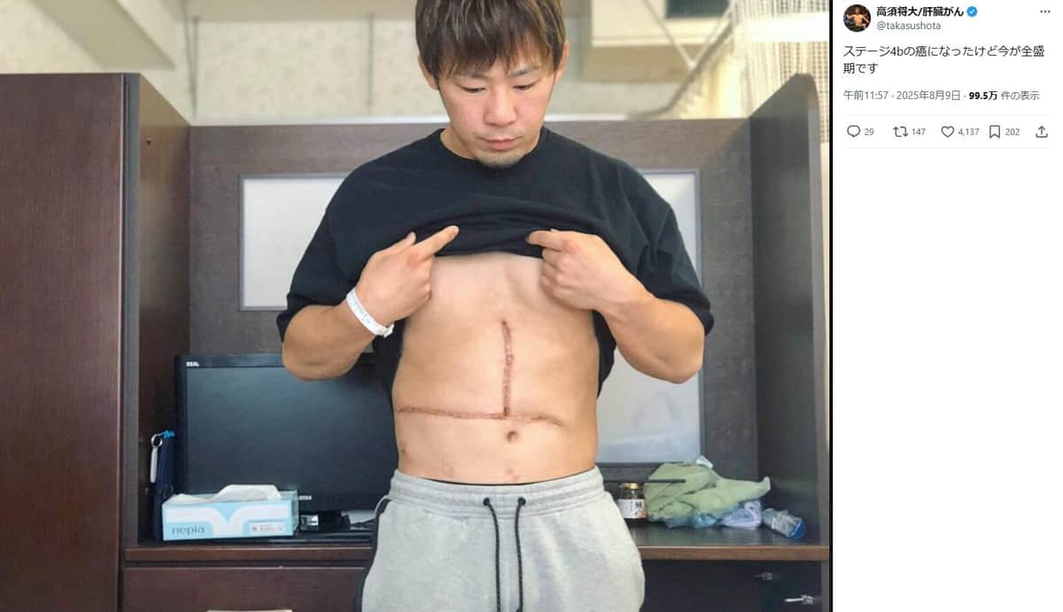 高須将大さんのX（＠takasushota）より