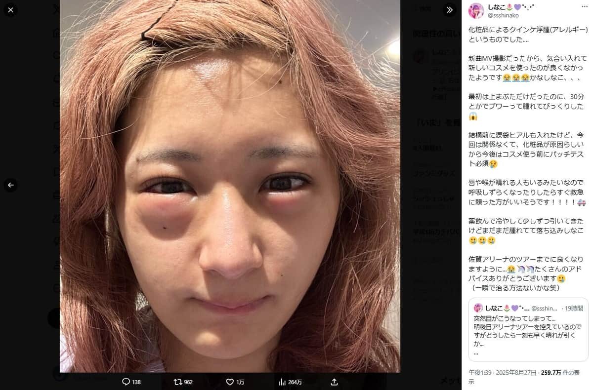 しなこさんのX（＠ssshinako）より