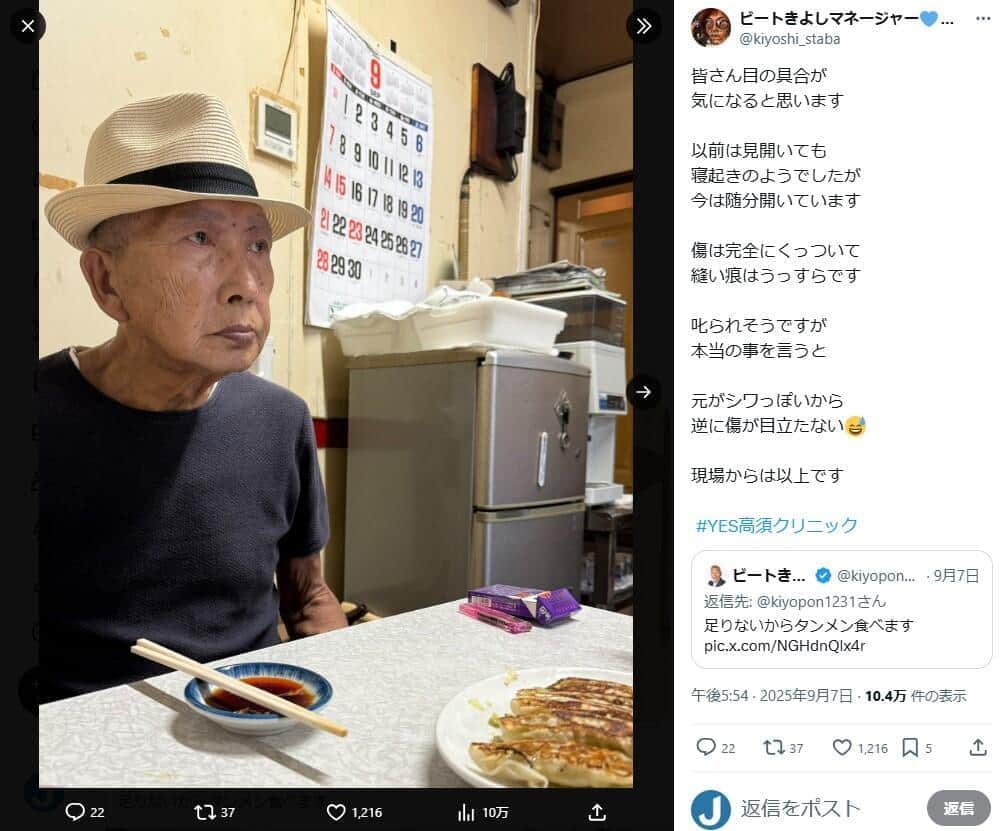 抜糸から1週間後のビートきよしさん、マネジャーのX（＠kiyoshi_staba）より