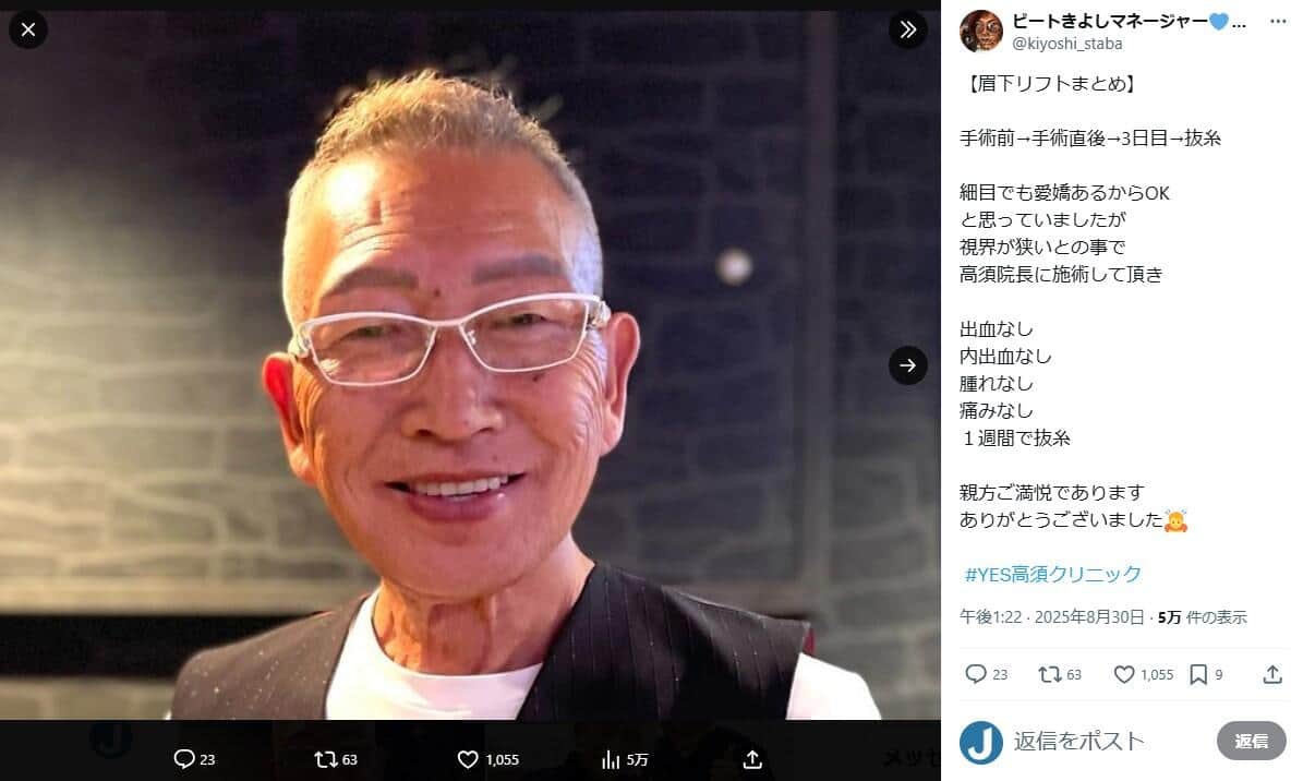全身がん公表の高須克弥氏、75歳芸人に整形手術　抜糸1週間で「縫い痕はうっすら」