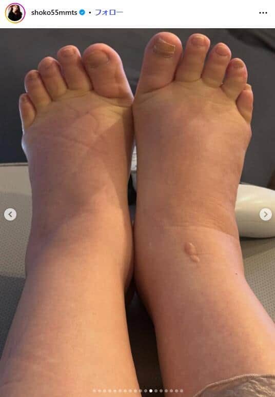 中川翔子さんのインスタグラム（＠shoko55mmts）より