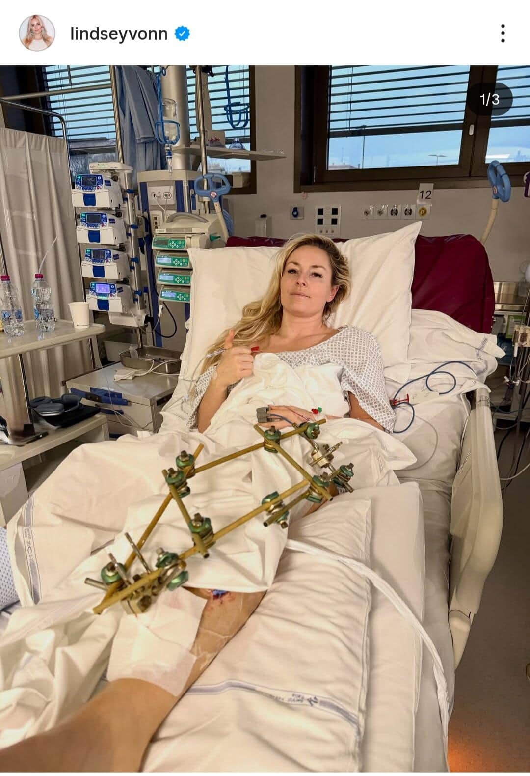 リンゼイ・ボン選手のインスタグラム（＠lindseyvonn）より