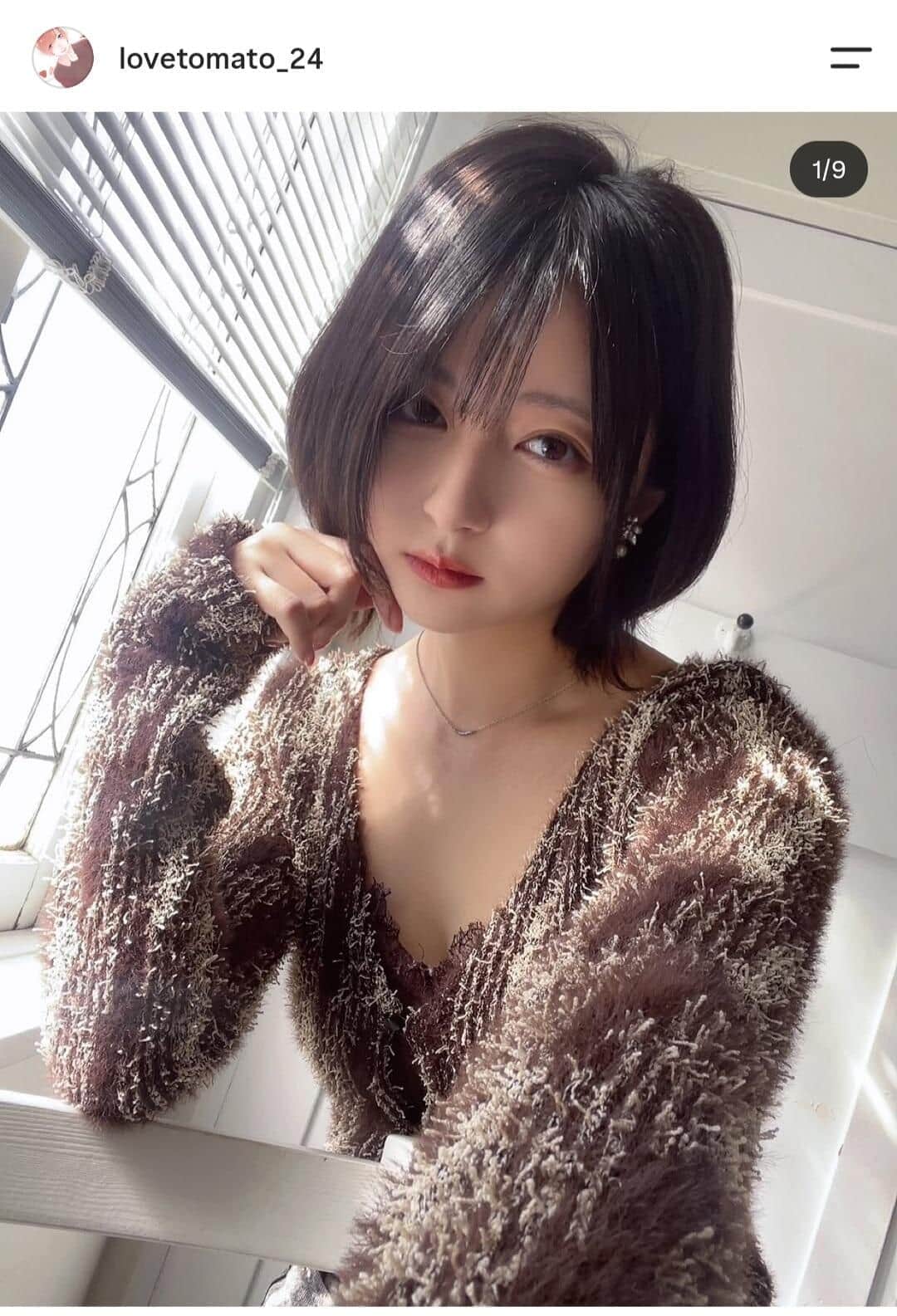 人気美容系YouTuber・こばしり。滞在中のオーストラリアで「髄膜炎」に...人生初の入院　「頭痛の痛さ＋嘔吐＋おかしいなと」