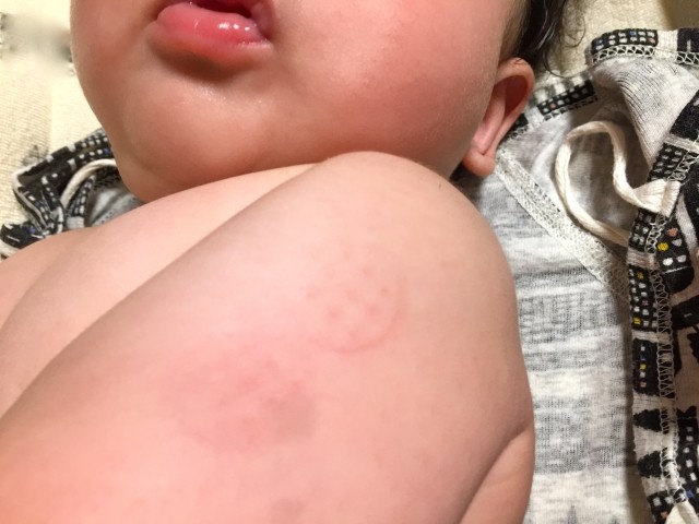 子どもの予防接種 義務 ではないが 感染すると治療法なく重症化の危険 J Cast ニュース 全文表示 子どもの予防接種 義務 ではないが 感染すると治療法なく重症化の危険 J Cast ニュース 全文表示