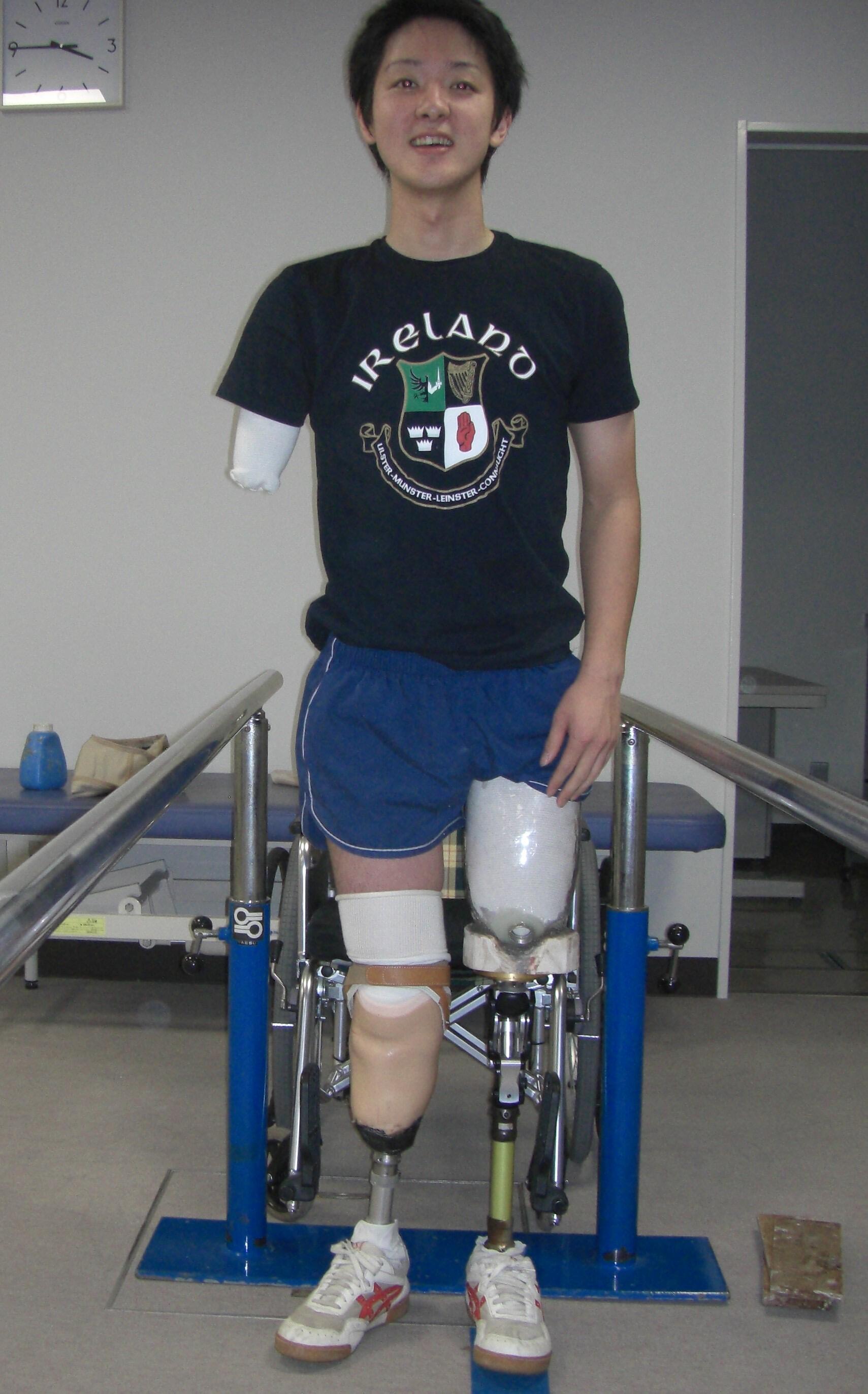 義足　両足 Daily Life] Putting on a prosthetic leg [Prosthetic Leg YouTuber