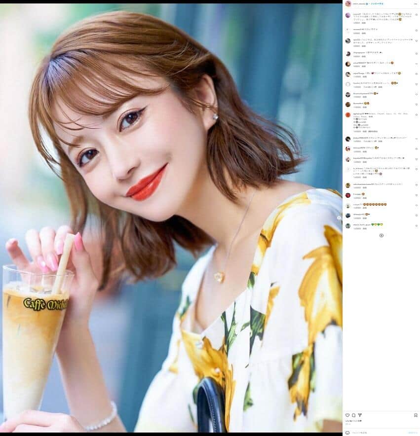 元キャバ嬢モデル、ヒアルロン酸除去で悲劇 額に凹み＆皮膚シワシワに