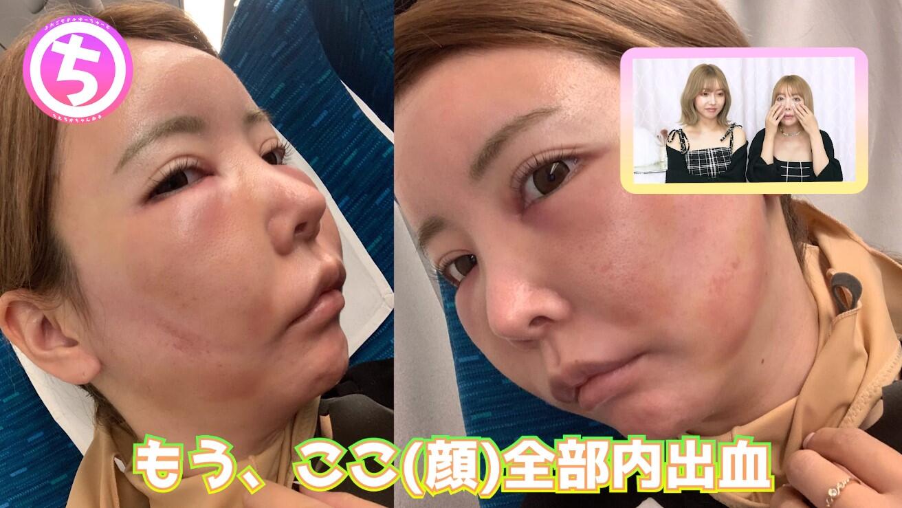 吉川 ちえ ちか