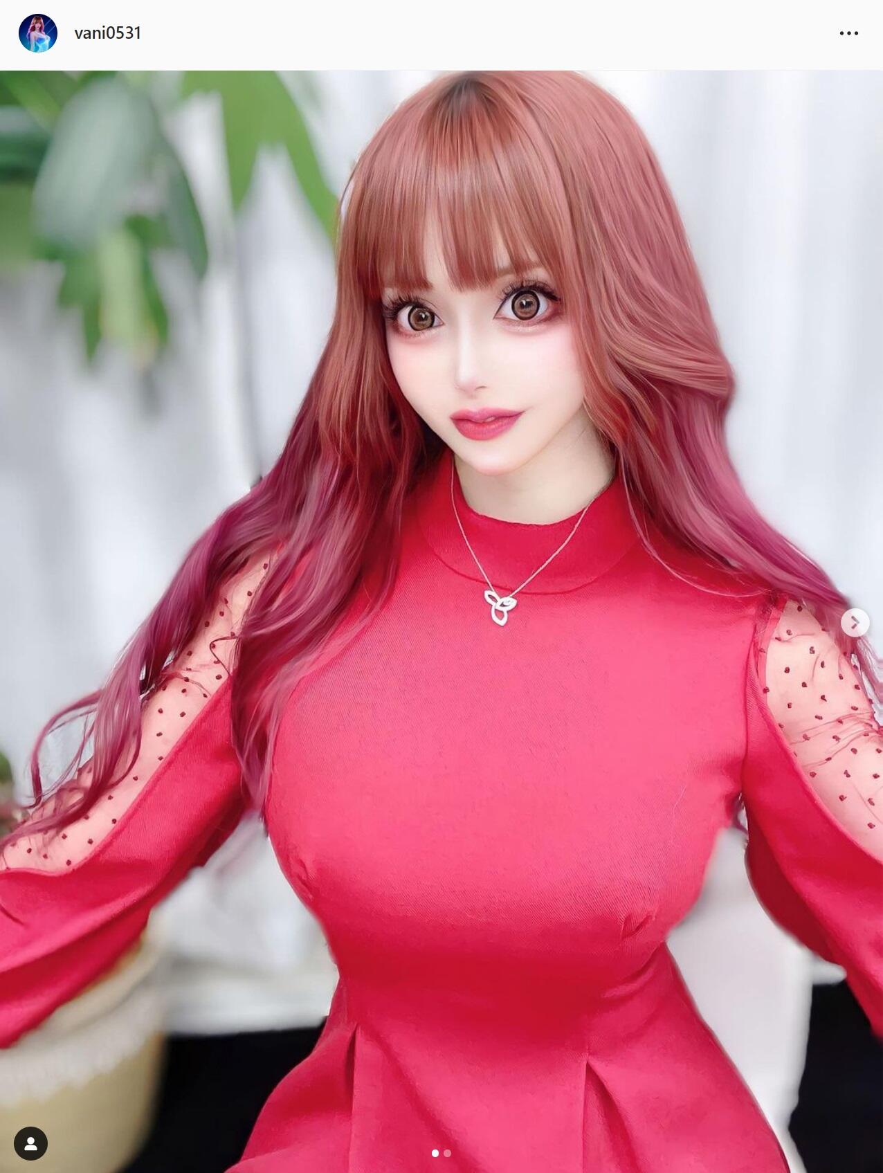 整形後トラブルで再手術も...「またお金払わされた」「こっち負担なんだ」 3億円整形タレント泣き寝入りの過去: J-CAST ニュース