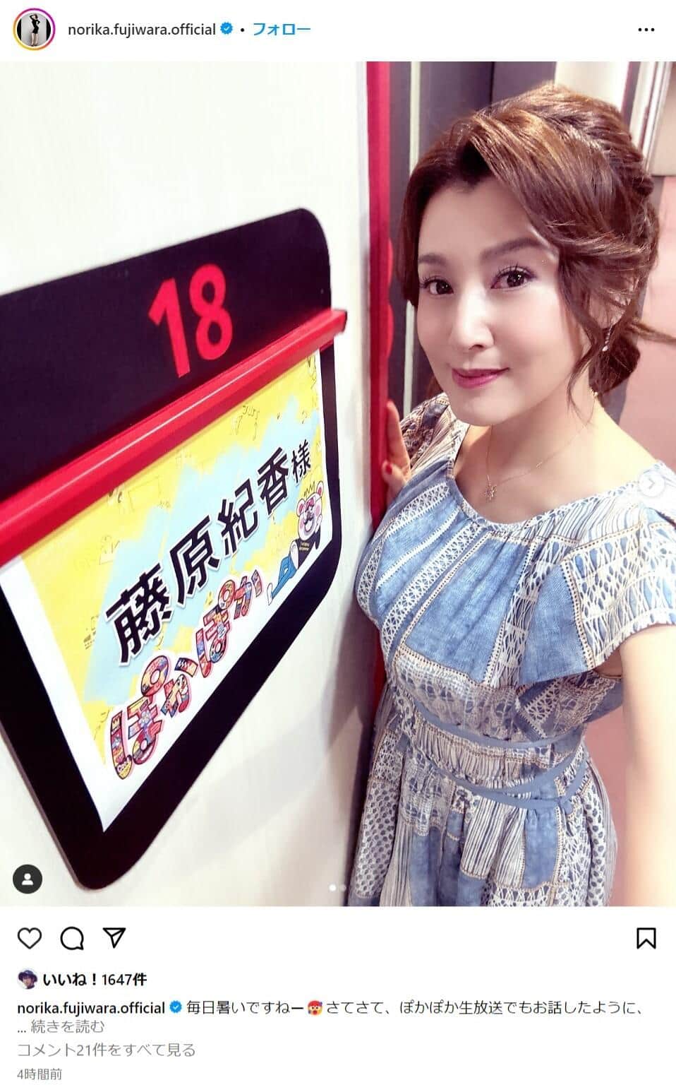 藤原紀香、コロナ禍で「大きな円形脱毛症になっちゃって。ボーン、って