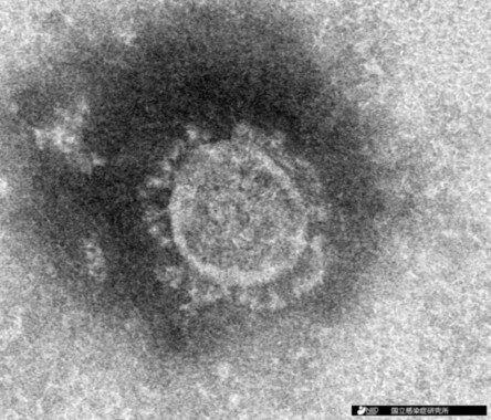 新型コロナウイルスの電子顕微鏡写真 (国立感染症研究所提供)