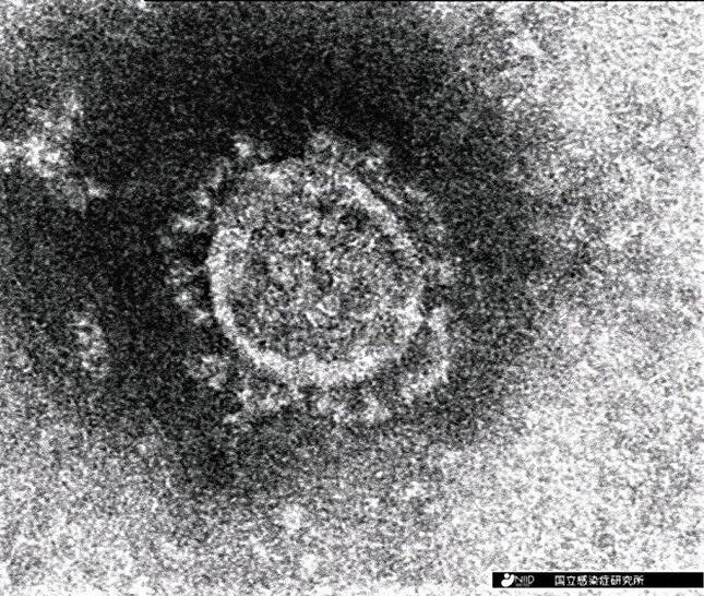 インド型変異ウイルスは感染力が強い（国立感染症研究所提供）