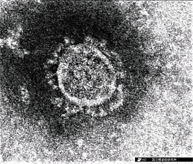 猛威を振るった新型コロナウイルスの感染第7波……　どうなるのか？（写真は、国立感染症研究所提供）