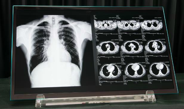 JOLED、有機ELパネルを出荷開始　世界初の「印刷方式」採用