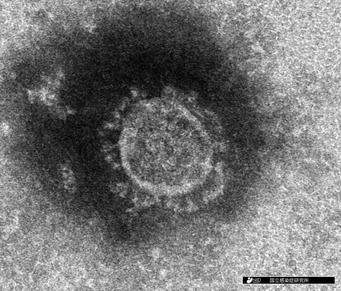 国立感染症研究所で分離に成功した新型コロナウイルスの電子顕微鏡写真 (国立感染症研究所提供)