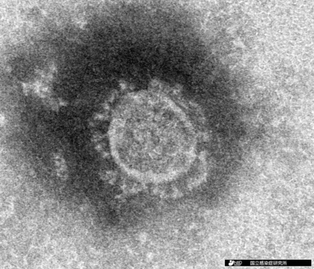 採用や就活にも暗い影を落とし始めた……(国立感染症研究所提供)